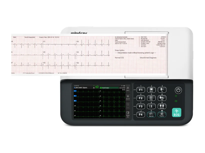 Eletrocardiógrafo BeneHeart R300